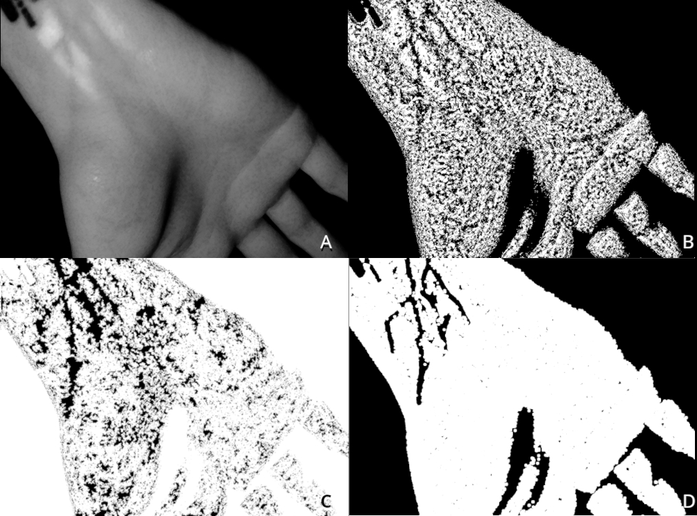 Screencap of veins in an arm using a pi camera module, IR filter and lights.